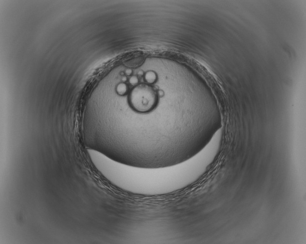 X0000115121016200911101622