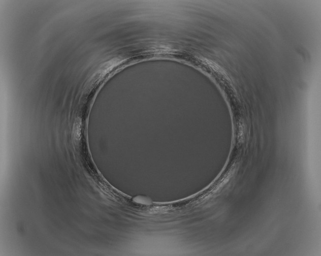X0000115121161200911101620