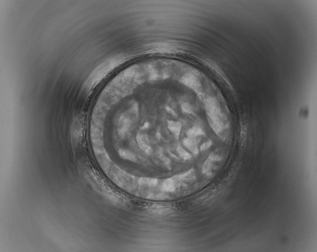 X0000115120874200911171325