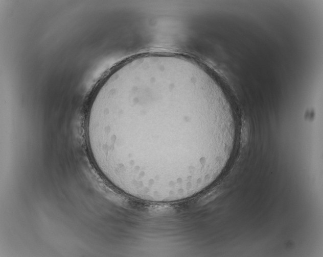 X0000115121454200911171317