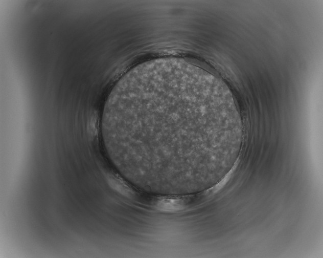 X0000115120174200911241354