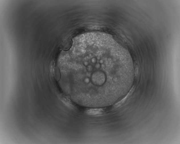 X0000115120179200911241354