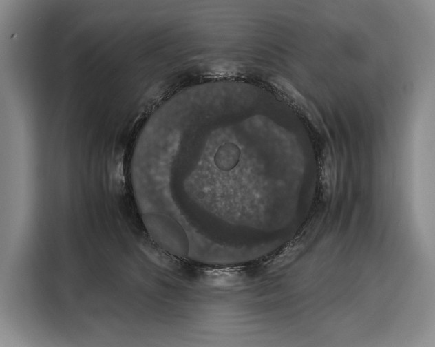 X0000115120516200911241350