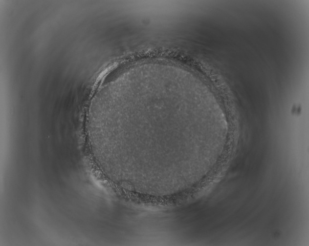 X0000115120144200912081353