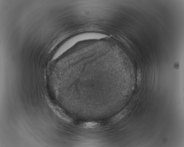 X0000115120158200912081352