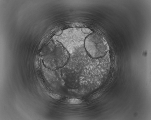 X0000115120169200912081352