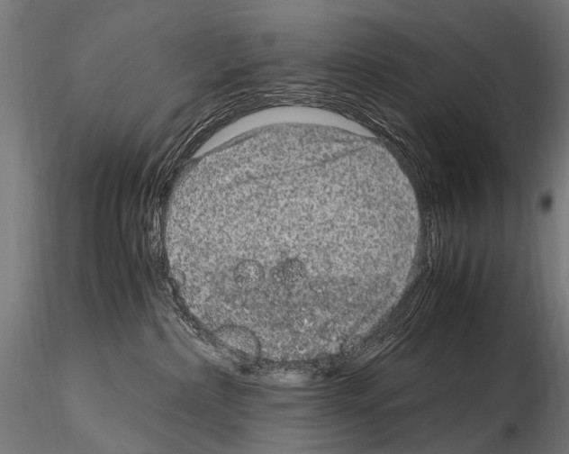 X0000115120236200912081352