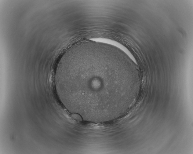 X0000115130424200911101651