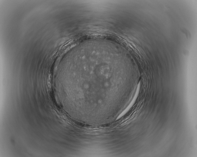 X0000115131156200911101641