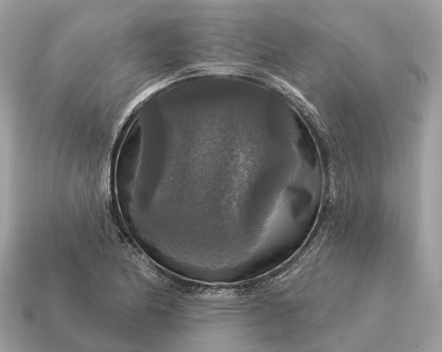 X0000115131174200911101641