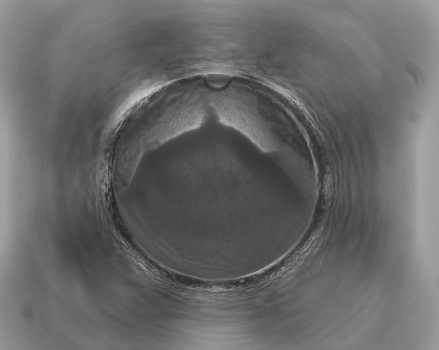 X0000115131359200911101638