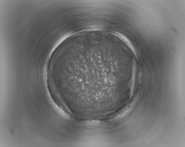 X0000115130859200911171158