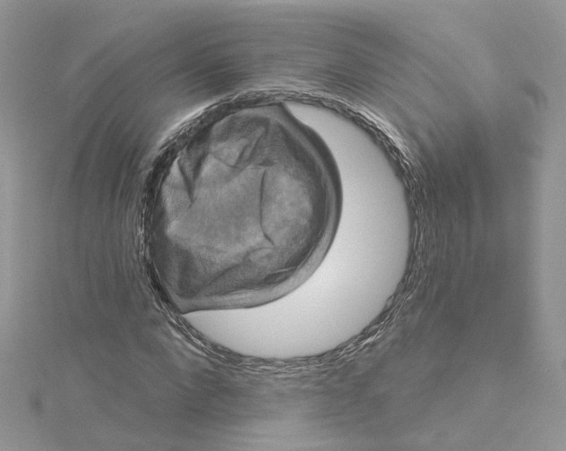 X0000115130872200911171158