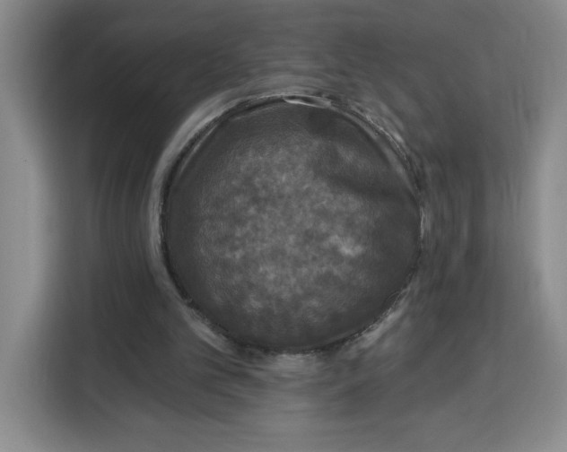 X0000115130101200911241454