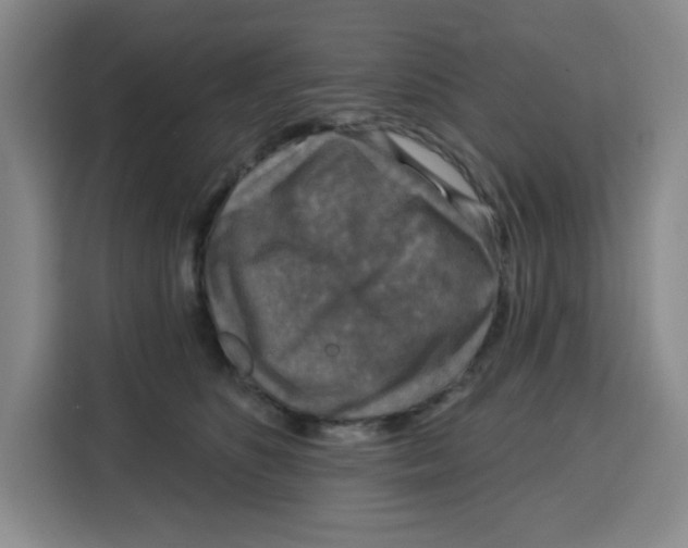 X0000115130516200911241448