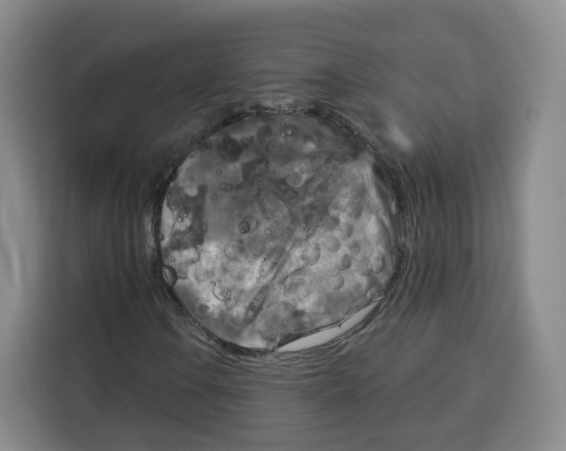 X0000115131106200911241440
