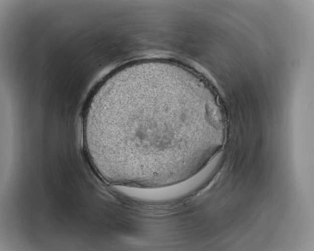 X0000115131171200911241440