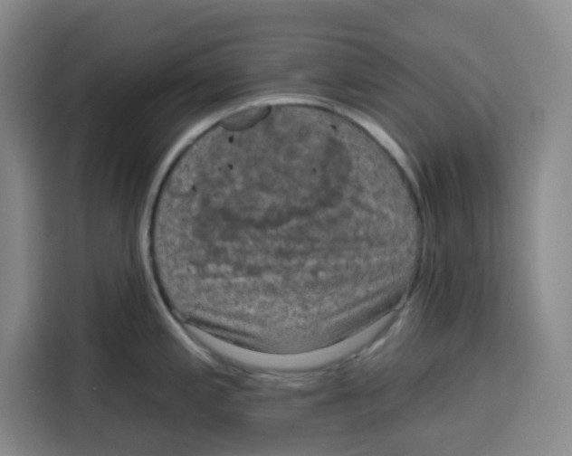 X0000115131197200911241439