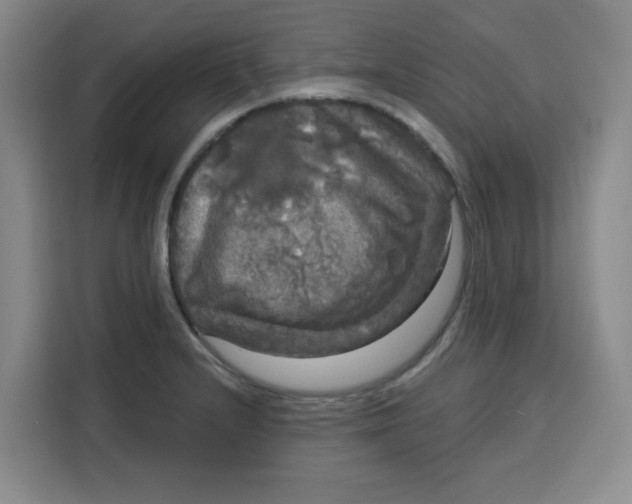 X0000115131232200911241439