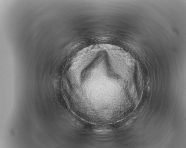 X0000115140181200911101715