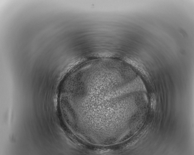 X0000115140206200911101715
