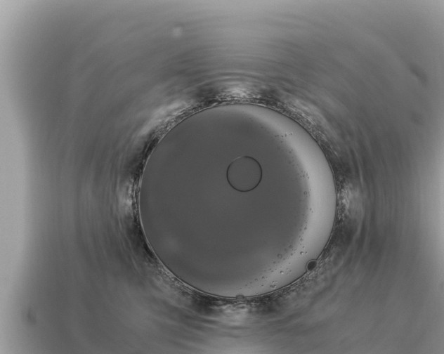 X0000115140423200911101711