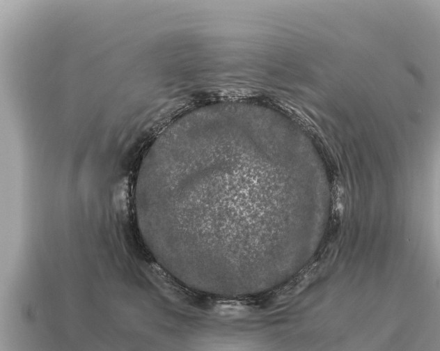 X0000115140519200911101710