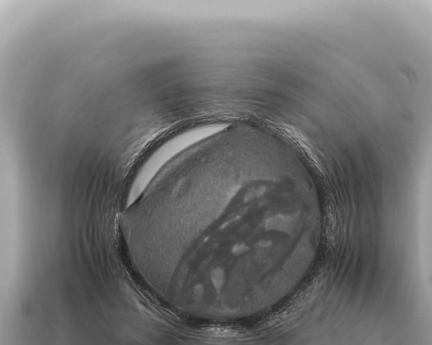 X0000115140596200911101709