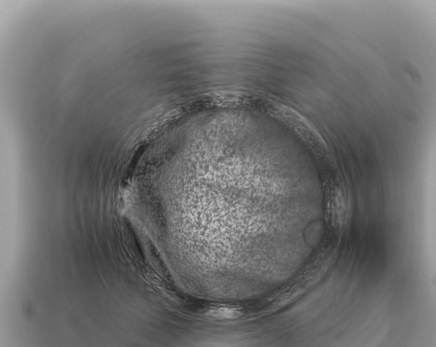 X0000115140610200911101709