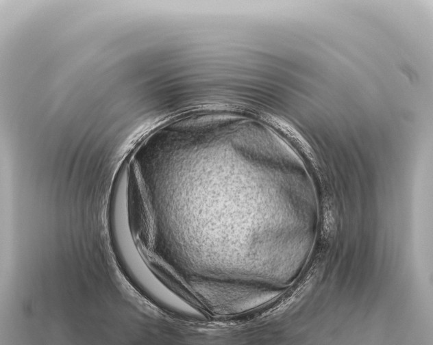 X0000115140938200911101705