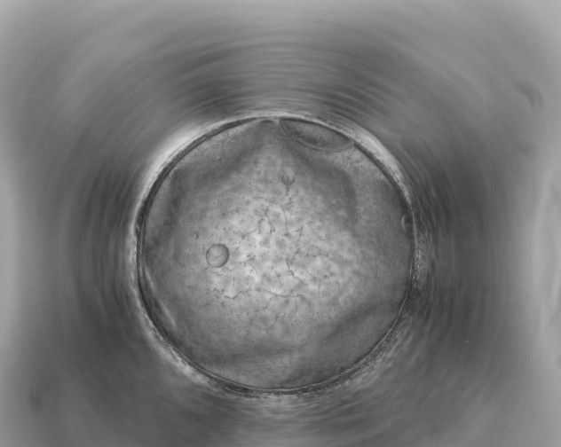 X0000115141096200911101702