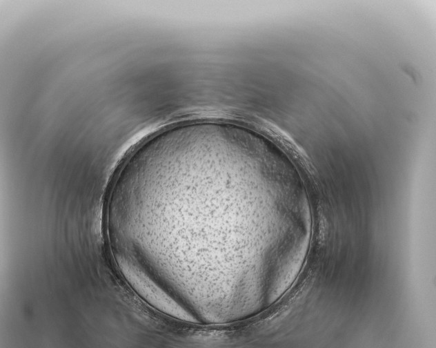 X0000115141174200911101701