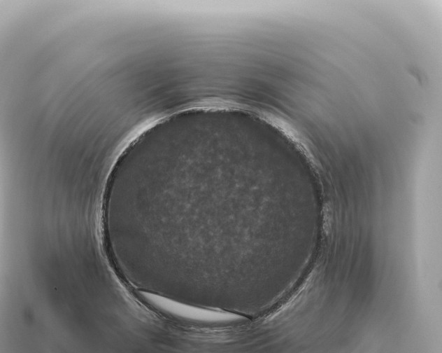 X0000115141229200911101701