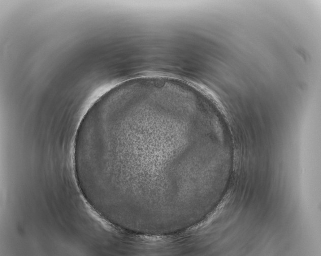 X0000115141231200911101701