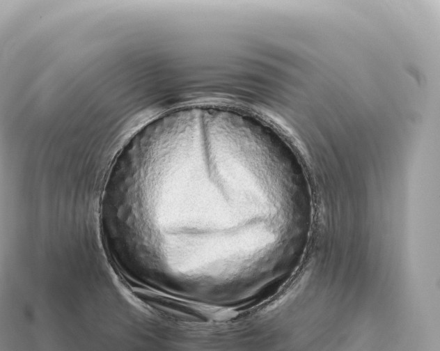X0000115141425200911101658