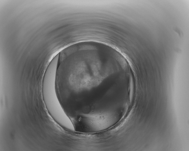 X0000115141529200911101657