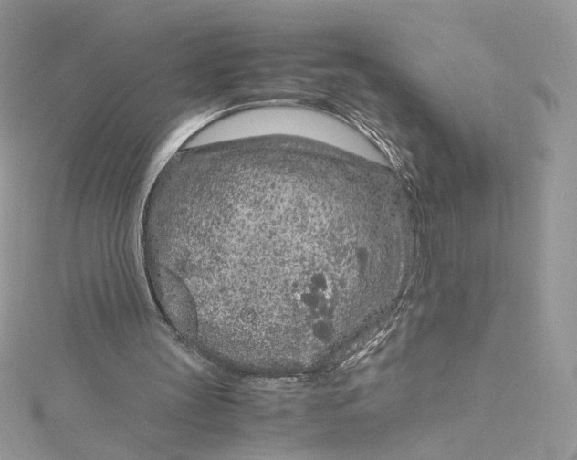 X0000115140147200911171227