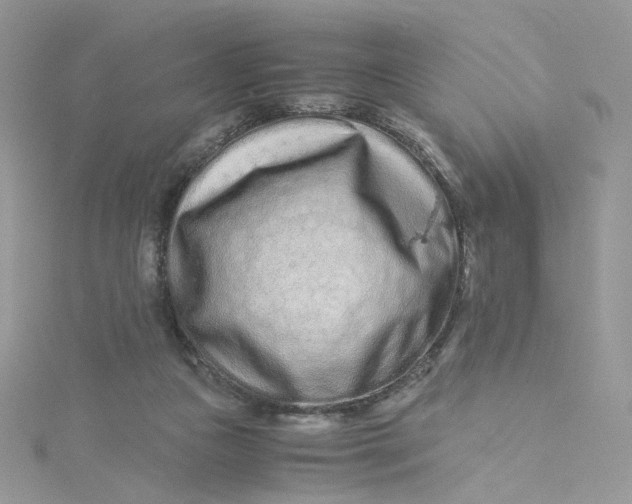 X0000115140161200911171227