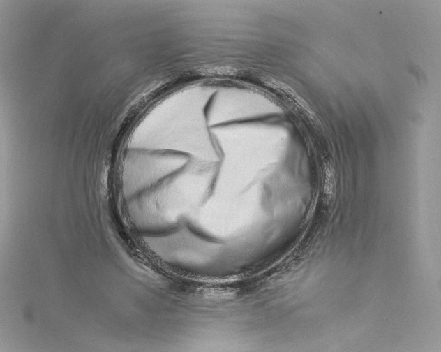 X0000115140491200911171223