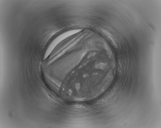 X0000115140596200911171222