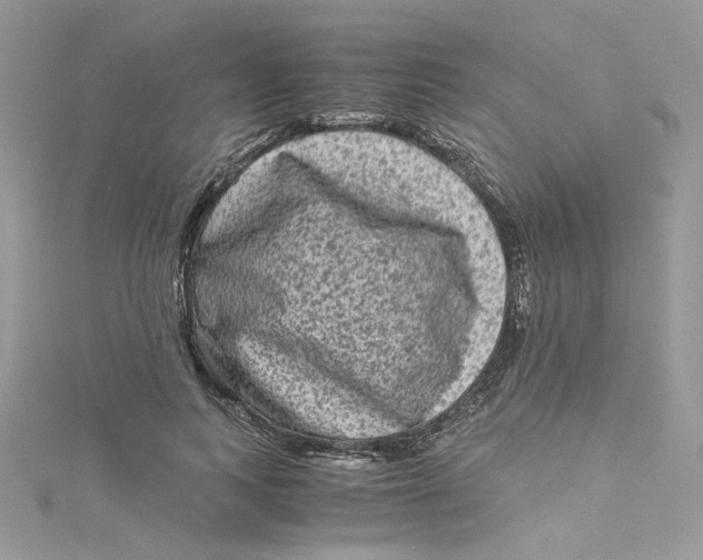 X0000115140743200911171220