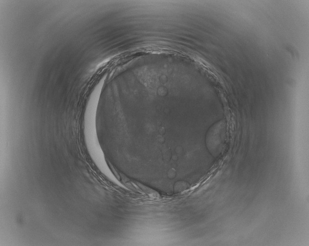 X0000115140822200911171218