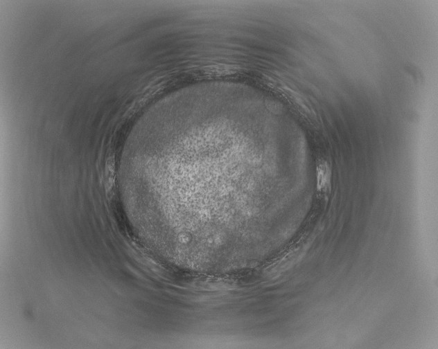 X0000115141011200911171216