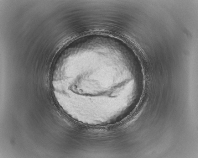 X0000115141121200911171215