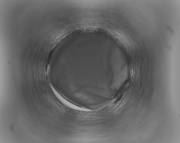 X0000115141252200911171213