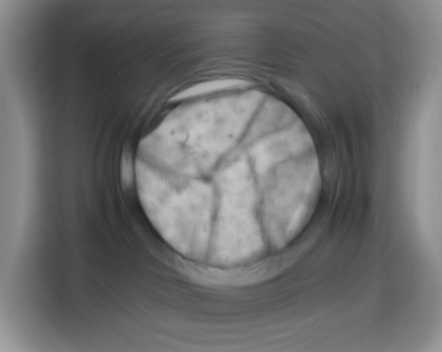 X0000115140046200911241514