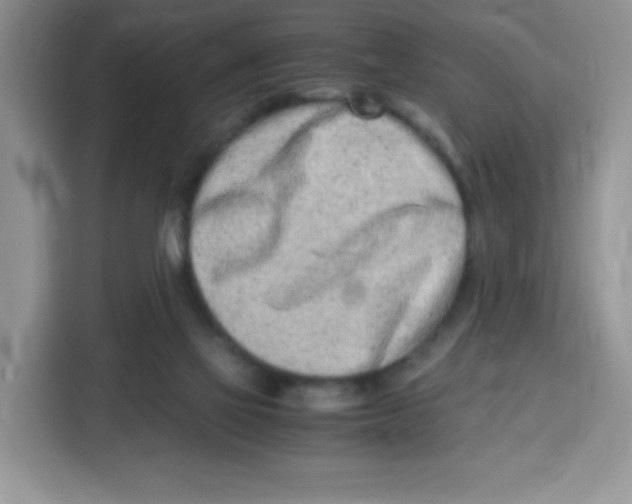 X0000115140069200911241514
