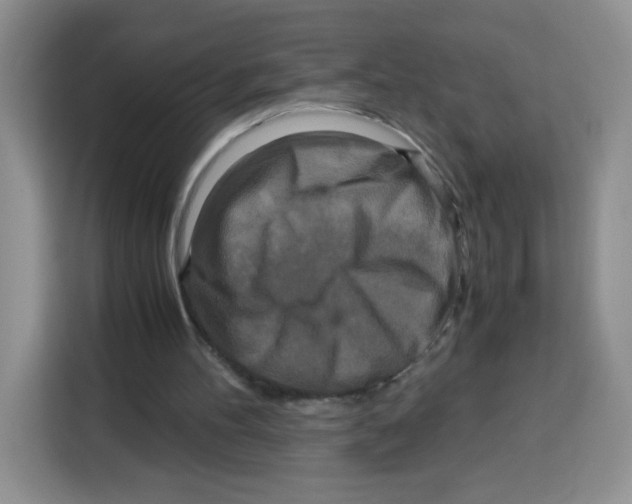 X0000115140100200911241514