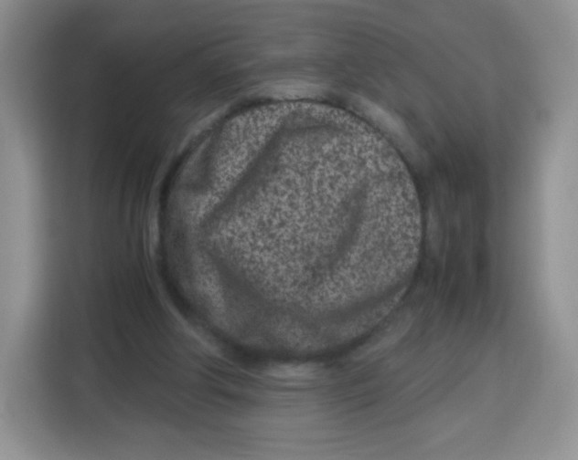 X0000115140202200911241512