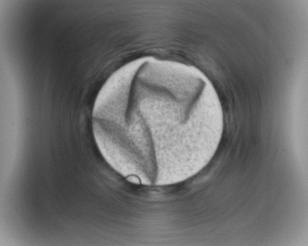 X0000115140229200911241512